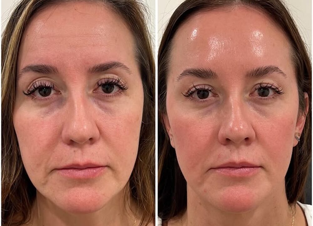 👇 Bye-Bye Eye Wrinkles_ The Cream That Works 💯 [#joc3] 1